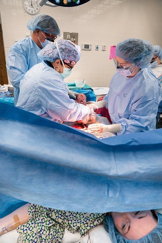 doctor pulling out baby during c-section :: birth photography