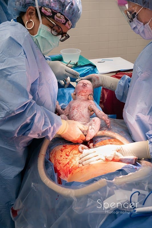 newborn baby immediately after birth :: birth photography